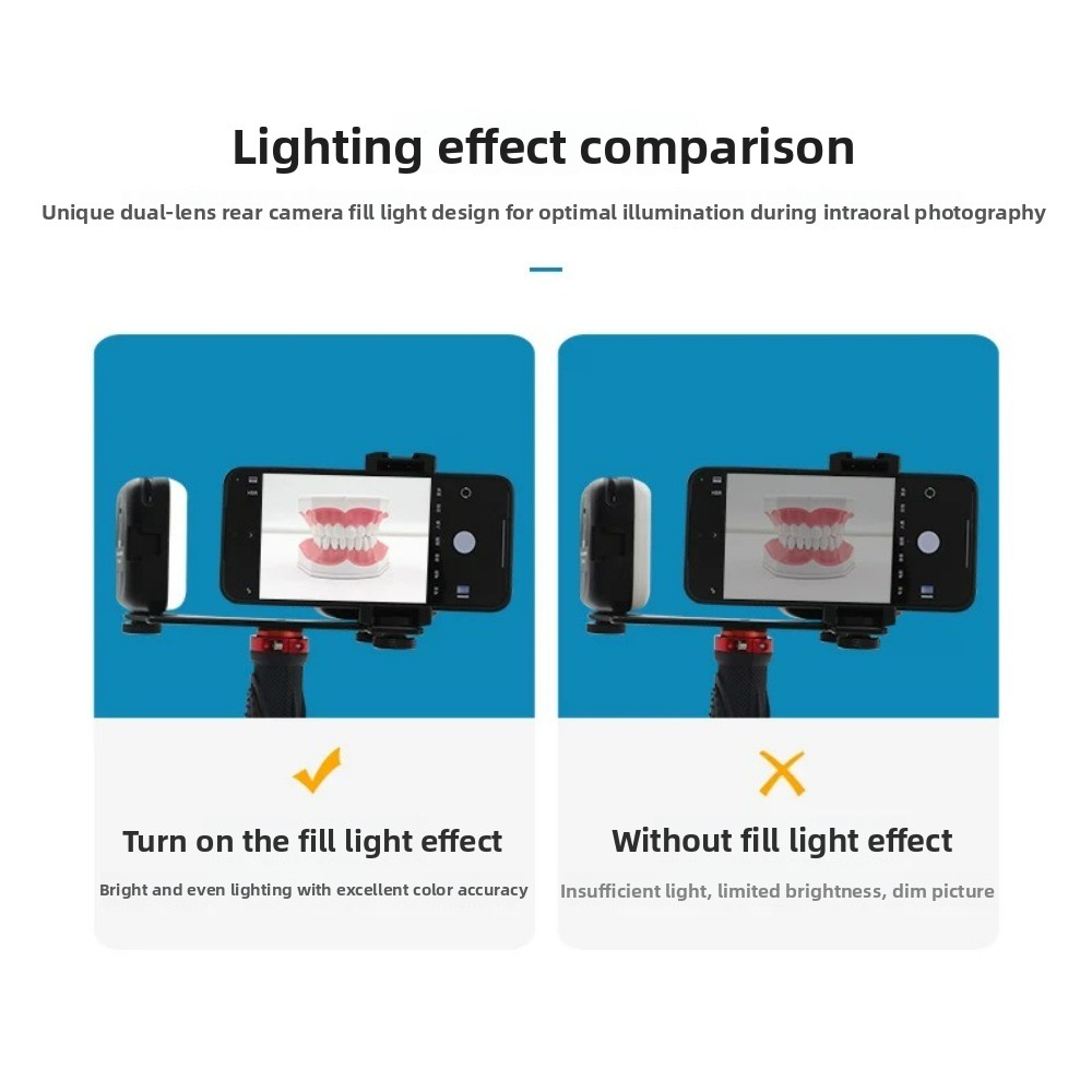 Luz de fotografía dental, flas - Photography Basics reseña y precio